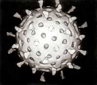 Virus - ilustrační foto. Zdroj: Wikipedia.org